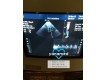 Philips HDI5000 2004-фото-7
