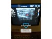 Philips HDI5000 2004-фото-8