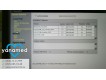 Siemens Acuson X300 PE 2012 1-фото-6