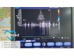 Siemens Acuson X300 PE 2012 1-фото-7