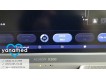 Siemens Acuson X300 PE 2012 1-фото-8