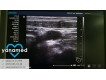 Siemens Acuson X300 PE 2012 1-фото-9