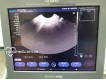 Siemens Acuson X300 PE 2012-фото-10
