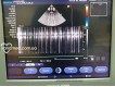Siemens Acuson X300 PE 2012-фото-9